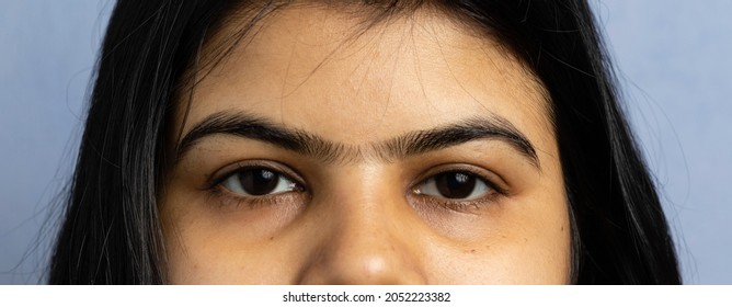 Close Up View Of Unibrow Of A Woman