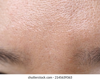 Close up view of a woman's oily skin with big pores on the forehead 