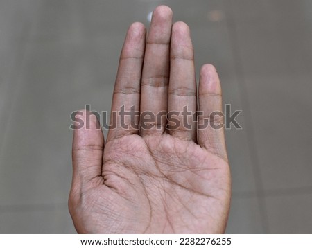 Close up view of young human hand (simianline, simian lines on palm, white young human hand with fingers, head and heart lines combined into one line (sometimes called Simian Crease)
