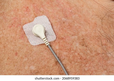 close up of a white lead of an electrocardiography ECG EKG electrode and cable for a heart monitor on an elderly Caucasian male patient