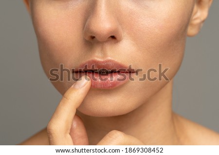 Close up of woman applying moisturizing nourishing balm or ointment to her lips with her finger to prevent dryness and chapping in the cold season. Lip protection. 