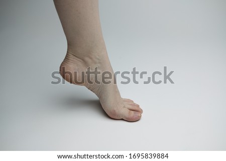close up of a woman arching her foot with bruising, veins, and broken toenail