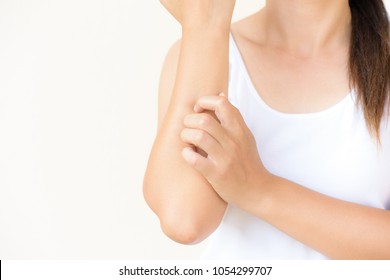 Close Up Woman Arm Scratch The Itch By Hand At Home. Healthcare And Medical Concept.