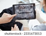 Close up woman dentist holding patient mouth digital film.Female doctor showing patient oral scan