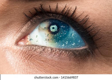 CLOSE OF WOMAN EYE HYDRATED BY THERAPEUTICAL EYE DROPS WITH HEALING EFFECT, MEDICAL BACKGROUND