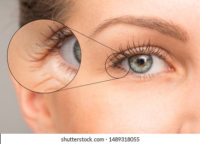 Close Up Of Woman Eye With Wrinkles