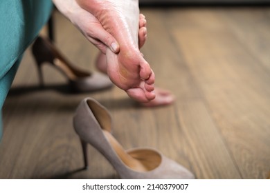 Close Up Of Woman Feet With Callus. Bad Health Problem Of Wrong Shoes. Pain In The Feet