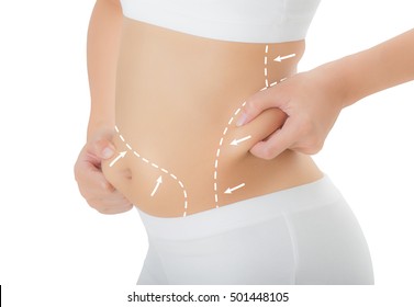 Close up woman grabbing skin her hip   belly and the drawing arrows  Lose weight   liposuction cellulite removal concept  Isolated white background 