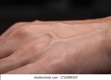 Close Up Of Woman Hand With Blood Vain On Skin 