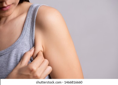 Close Up Woman Pulling Her Skin Underarm. Problem Armpit Fat Skin Concept.