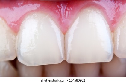 Close Up Of Woman Teeth Background