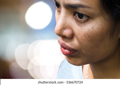 Close Up Of Women Freckle, Dark Spot On Face, Dried Skin Issues, Need Treatment. Asian Middle Age Women