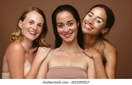 Close Up Of Women With Skin Problems Together On Brown Background. Portrait Of Three Confident Women With Skin Condition.