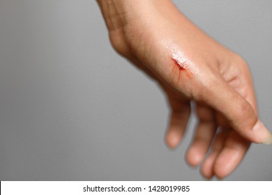 Close Wound On Hands Bleeding Stock Photo 1428019985 | Shutterstock