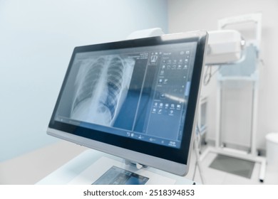 Close up of x-ray image of human chest lungs shown on the monitor screen modern laboratory equipment computer. Fluorography roentgenography medicine and health concept.