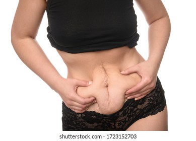 Close Up Of Young Woman Abdomen Showing Loose Skin From Post Partum Belly Fat In Black Underwear