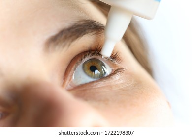 Close up to young woman applying eye drop. Vitamin drops from tiredness and redness eyes. Suffering from irritated eye, optical symptoms. 