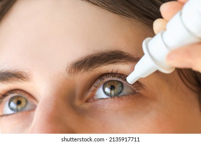 Close Up To Young Woman Applying Eye Drop. Vitamin Drops From Tiredness And Dry Redness Eyes. Suffering From Irritated Eye, Optical Symptoms. 