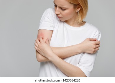 Close up of young woman scratching the itch on her hand, isolated on grey background. Dry skin, animal/food allergy, dermatitis, insect bites, irritation concept. 