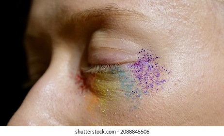 Closed Eyes Of Gay Lesbians With Rainbow Makeup. Albino Woman Girl With Acne Celebrates New Year. Diversity Of The Person In The Day Of Dignity