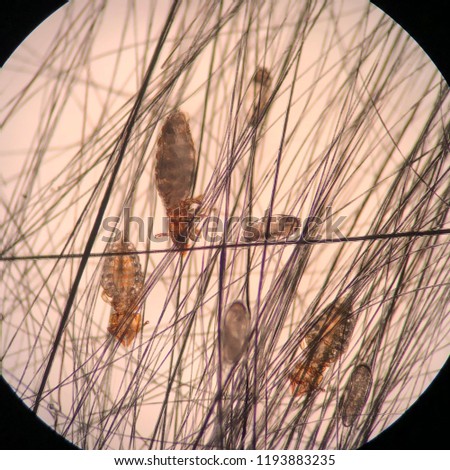 Closed up to lice and egg lice from the microscope.