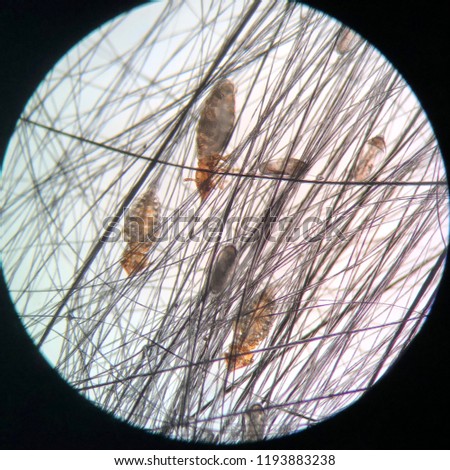 Closed up to lice and egg lice from the microscope.