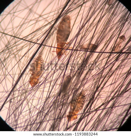 Closed up to lice and egg lice from the microscope.