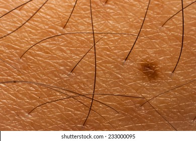 Closed Up Of Skin With Pigment And Body Hair