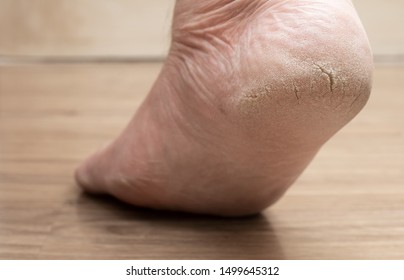 Rough Feet Images Stock Photos Vectors Shutterstock