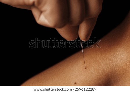 Close-up of acupuncturist's hand inserting a needle into shoulder skin. Traditional Chinese medicine treatment for pain relief and holistic healing. Alternative therapy and natural healthcare concept.