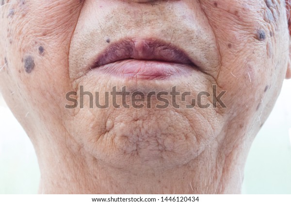 Closeup of age spots skin (liver spots) in 90\
years old man.Concept : Skin repair and treatment for elderly and\
aged people.Selective\
focus.