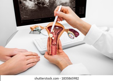 Close-up anatomical model of the uterus with pathologies. Gynecologist showing the polyps of the uterus. Gynecological diseases and treatments