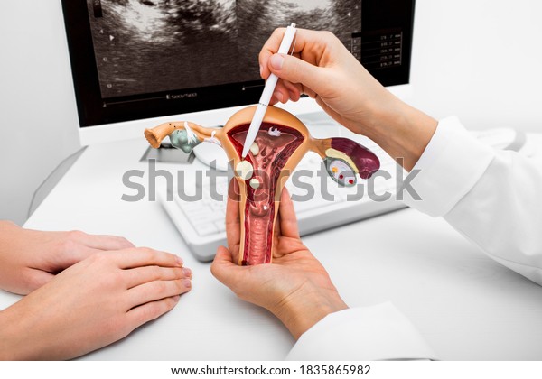 Close-up anatomical model of the uterus with\
pathologies. Gynecologist showing the polyps of the uterus.\
Gynecological diseases and\
treatments