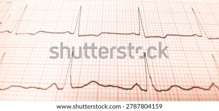 Close-up angled view of a printed electrocardiogram (ECG) graph showing heartbeat tracings on pink grid paper with a shallow depth of field.