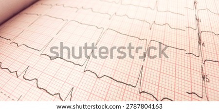 Close-up angled view of a printed electrocardiogram (ECG) graph showing heartbeat tracings on pink grid paper with a shallow depth of field.