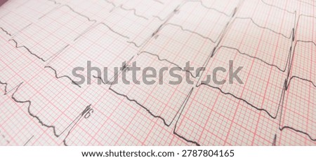 Close-up angled view of a printed electrocardiogram (ECG) graph showing heartbeat tracings on pink grid paper with a shallow depth of field.