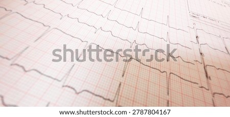Close-up angled view of a printed electrocardiogram (ECG) graph showing heartbeat tracings on pink grid paper with a shallow depth of field.