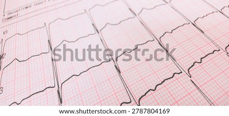 Close-up angled view of a printed electrocardiogram (ECG) graph showing heartbeat tracings on pink grid paper with a shallow depth of field.