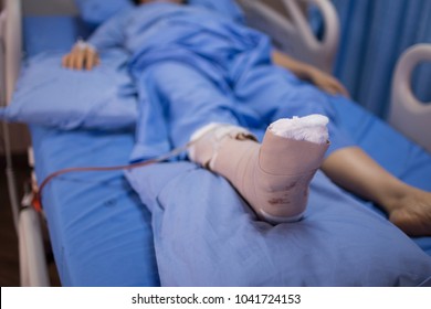 Close-up Ankle Surgery Covered By Splint In Hospital