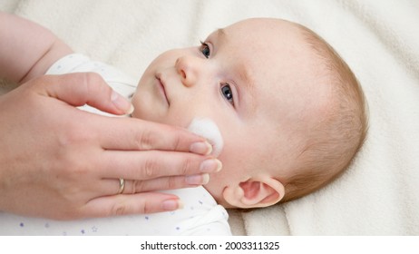 CLoseup Of Applying Moisturizing Creme On Baby Skin Suffering From Dermatitis. Concept Of Newborn Baby Health And Skin Care.