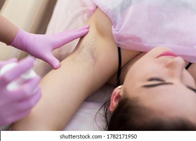 Close-up of armpit of a young lady with hair, hair removal procedure in a beauty salon. Beautician makes shugaring underarms for a young woman. Depilation of armpit with sugar paste
