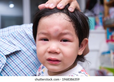 Closeup Of Asian Boy Face Sustained A Forehead Injury From A Fall. A 2-3 Year Old Child Cries From The Pain. A Bulging Head Baby. Grandpa's Hand Touches The Grandchild Head To Consolation.