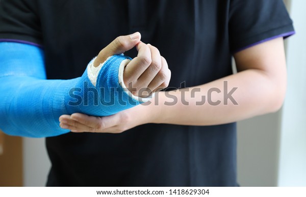 Closeup of asian man\'s arm\
with long arm plaster, fiberglass cast therapy cover by blue\
elastic bandage after sport accident. Appropriate treatment in\
western medicine.