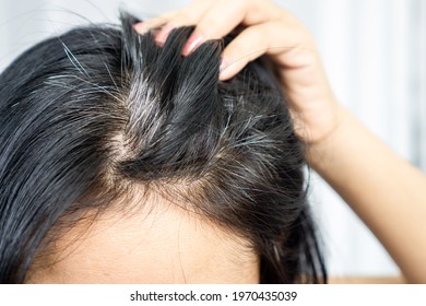 closeup Asian woman having problem with grey, white hair growing up 