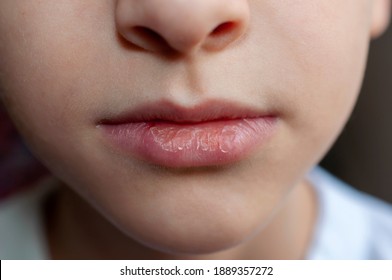Close-up of baby dry chapped lips, lip care, soft focus - Shutterstock ID 1889357272