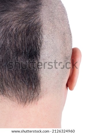 Closeup of the Back of a Man's Head Half Shaven with Exposed Scalp