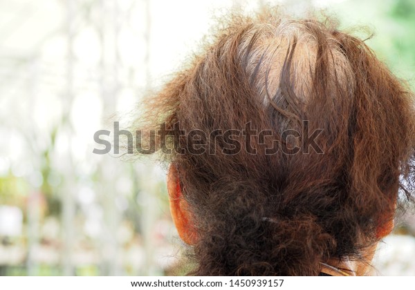 Closeup Back Side Old Woman Her Stock Photo Edit Now 1450939157