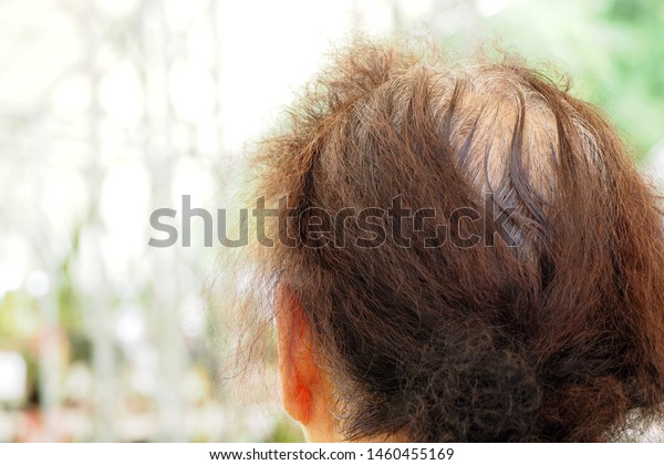 Closeup Back Side Old Woman Her Stock Photo Edit Now 1460455169