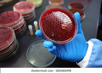 Close-up of Bacteria culture growth on Blood agar plate in Microbiology Laboratory, streptococcus suis type II