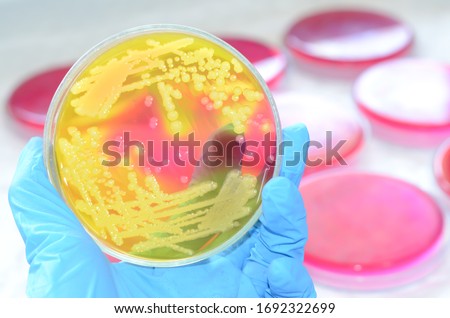 Close-up of Bacteria culture growth on Selective media plate in Microbiology Laboratory, salmonella spp.